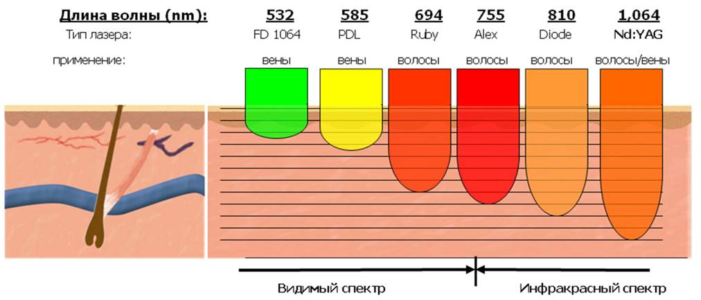 Применение лазеров с различными длинами волн 