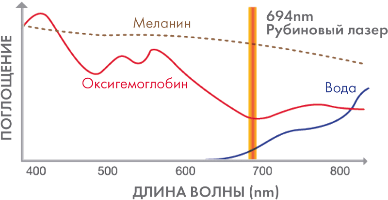 Рубиновый лазер 
